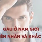 Gàu hình thành như thế nào? Làm sao để khắc phục?