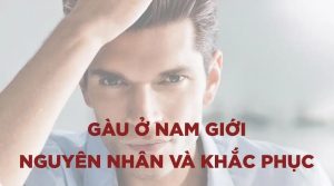 Gàu hình thành như thế nào? Làm sao để khắc phục?