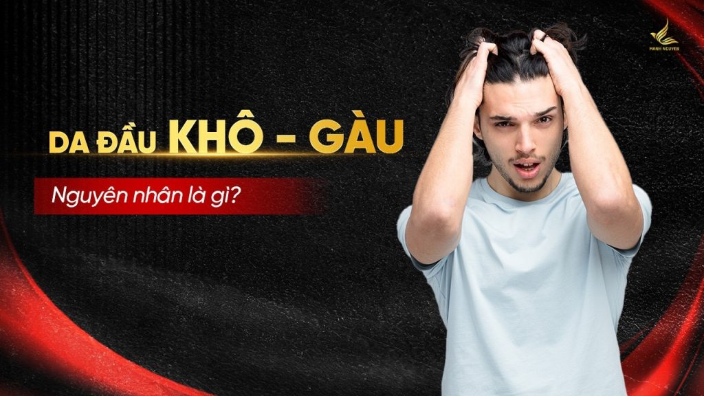 Nguyên nhân khiến da đầu khô, sinh gàu là gì?