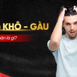 Nguyên nhân khiến da đầu khô, sinh gàu là gì?