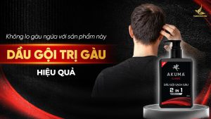 Không lo gàu ngứa với dầu gội AKUMA Classic