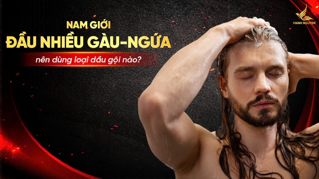 Nam giới đầu nhiều gàu nên chọn loại dầu gội nào?
