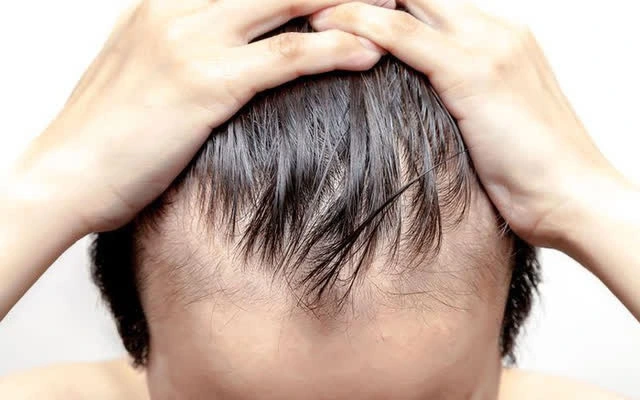 Mùa hè khiến mái tóc dễ đổ dầu, mồ hôi gây bết tóc